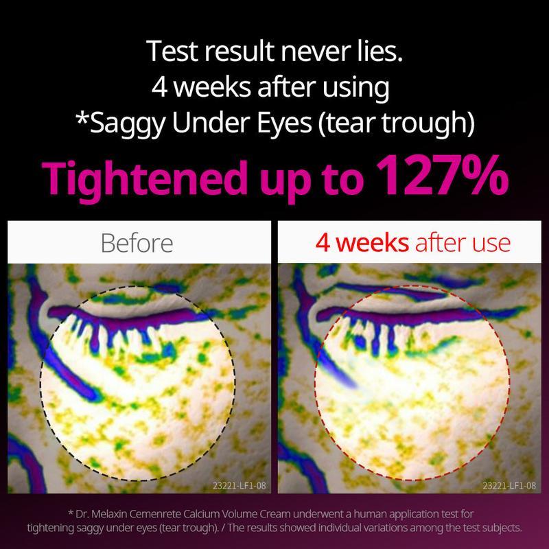 Cemenrete Calcium Dark Spot Eye Cream