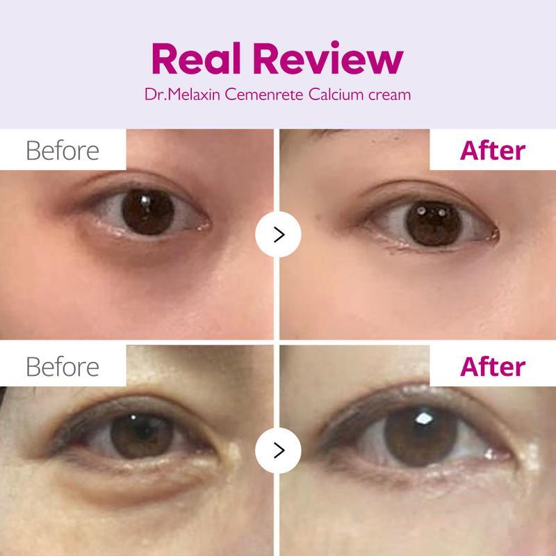 Cemenrete Calcium Dark Spot Eye Cream